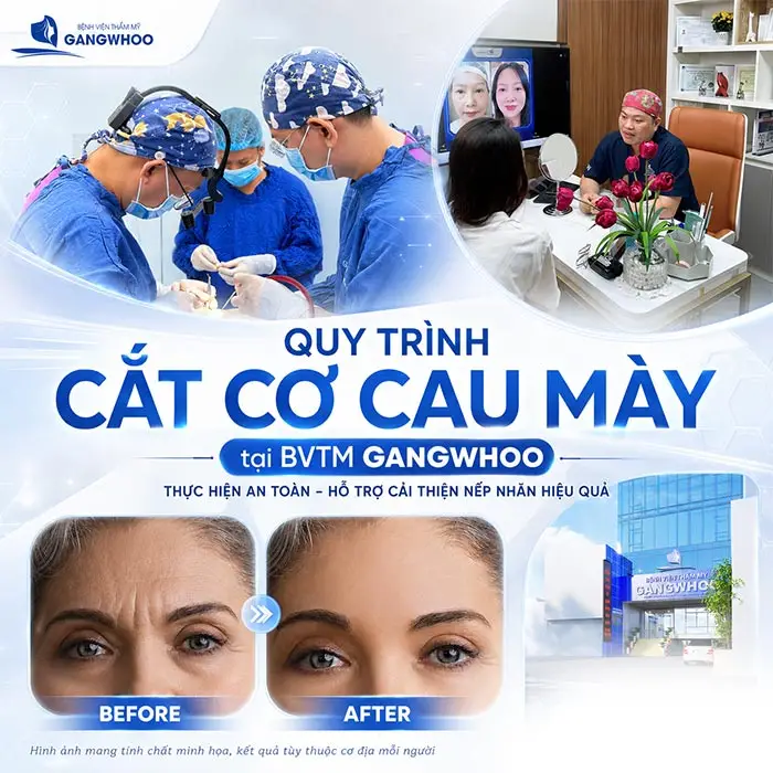Cắt Cơ Cau Mày Giá Bao Nhiêu? Bảng Giá Xóa Cau Mày 2026 5 Cắt Cơ Cau Mày Giá Bao Nhiêu? Bảng Giá Xóa Cau Mày 2026