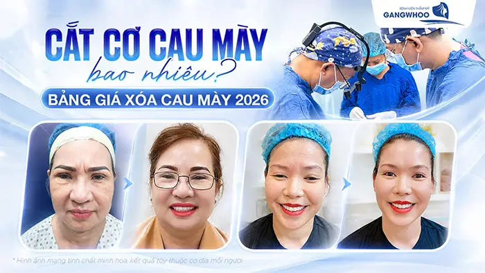 cat c cau may bao nhieu vn