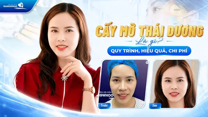cay mo thai duong bv