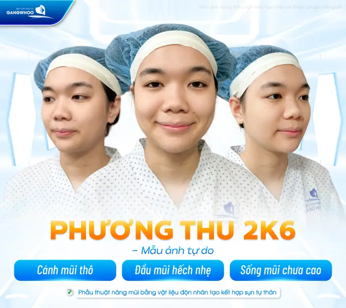 Từng Lỡ Nhiều Job Làm Mẫu Ảnh, GenZ 2K6 Quyết Định Nâng Mũi Để Không Bỡ Lỡ Cơ Hội