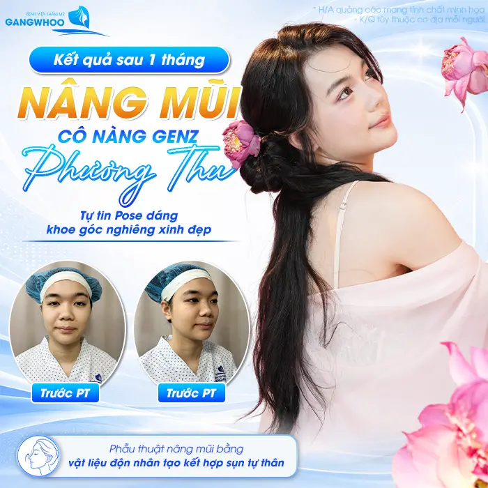 Từng Lỡ Nhiều Job Làm Mẫu Ảnh, GenZ 2K6 Quyết Định Nâng Mũi Để Không Bỡ Lỡ Cơ Hội