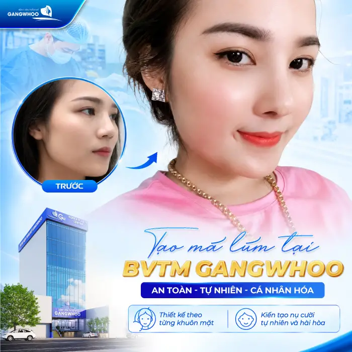 Má Lúm Đồng Điếu Là Gì? Ý Nghĩa, Cách Tạo Đẹp Tự Nhiên