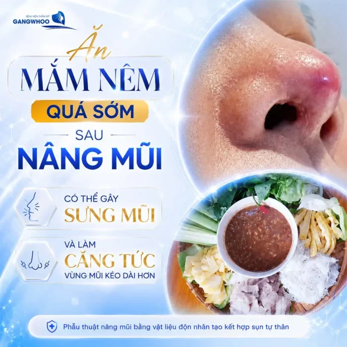 Nâng Mũi Ăn Mắm Nêm Được Không? Những Thực Phẩm Cần Tránh