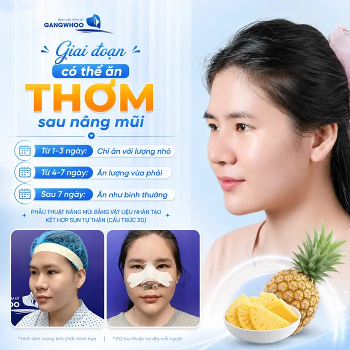 Nâng Mũi Ăn Thơm Được Không? Phải Kiêng Bao Lâu?