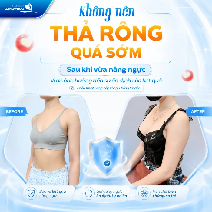 Nâng Ngực Bao Lâu Được Thả Rông? Bác Sĩ Giải Đáp Chi Tiết 1 Nâng Ngực Bao Lâu Được Thả Rông? Bác Sĩ Giải Đáp Chi Tiết
