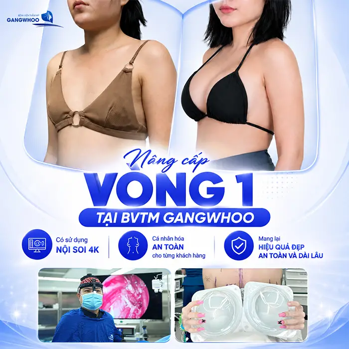 Bơm Ngực Khác Gì Nâng Ngực? Những Tiêu Chí Phân Biệt