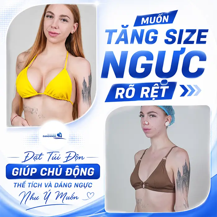 Bơm Ngực Khác Gì Nâng Ngực? Những Tiêu Chí Phân Biệt