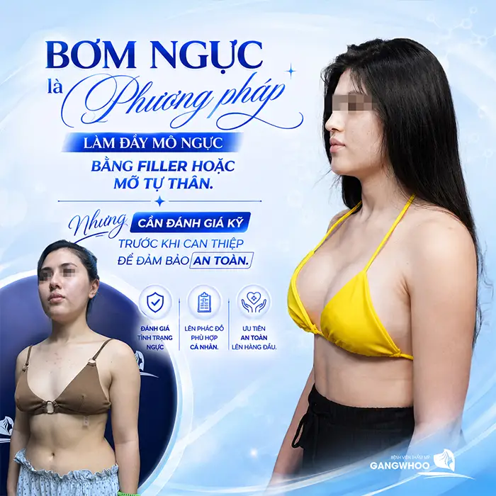 Bơm Ngực Khác Gì Nâng Ngực? Những Tiêu Chí Phân Biệt