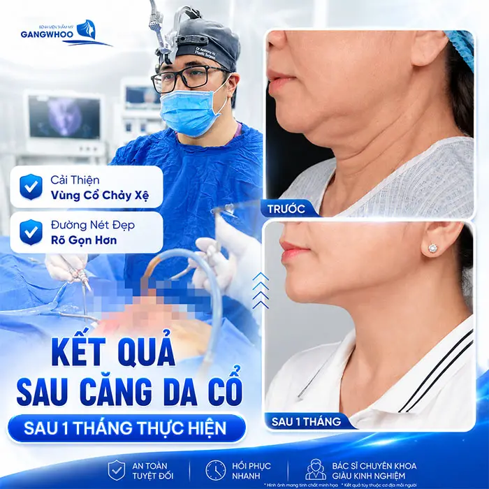 Căng Da Cổ Giá Bao Nhiêu? Bảng Giá Mới Năm 2026