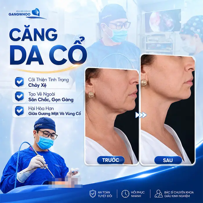 Căng Da Cổ Giá Bao Nhiêu? Bảng Giá Mới Năm 2026