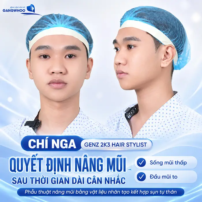 Chí Nga GenZ 2k3 quyết định nâng mũi sau thời gian dài cân nhắc