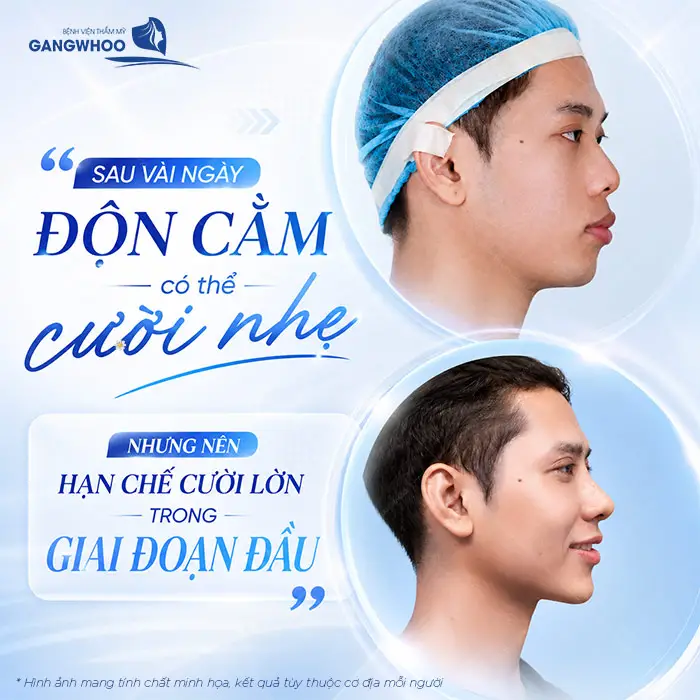 Độn Cằm Bao Lâu Cười Được? Hướng Dẫn Chăm Sóc Để Nhanh Hồi Phục