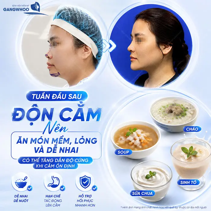 Độn Cằm Bao Lâu Cười Được? Hướng Dẫn Chăm Sóc Để Nhanh Hồi Phục