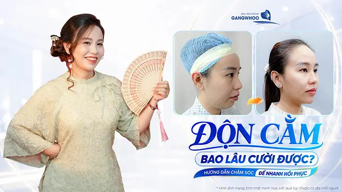 don cam bao lau thi cuoi duoc