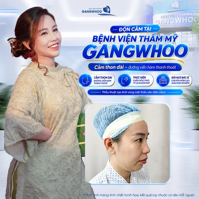 Độn Cằm Có Gây Mê Không? Khi Nào Gây Tê, Khi Nào Gây Mê?