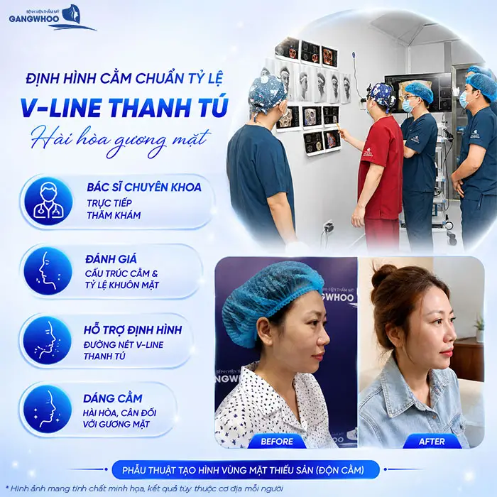 Độn Cằm Có Gây Mê Không? Khi Nào Gây Tê, Khi Nào Gây Mê?