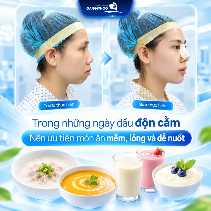 Độn Cằm Kiêng Ăn Gì? Kiêng Bao Lâu Để Nhanh Lành?