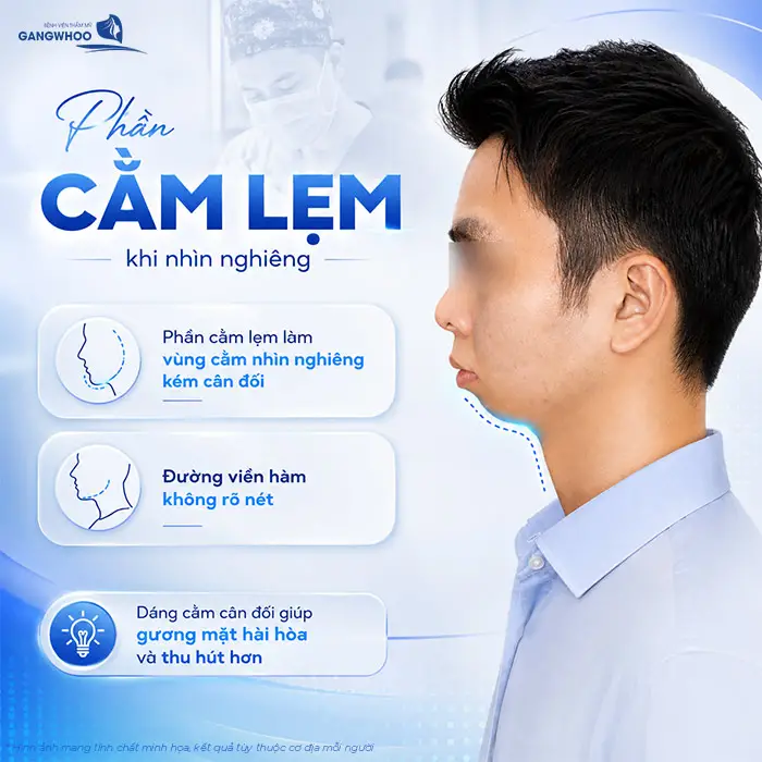 Độn Cằm Lẹm: Giải Pháp Cải Thiện Dáng Cằm Và Đường Nét Khuôn Mặt