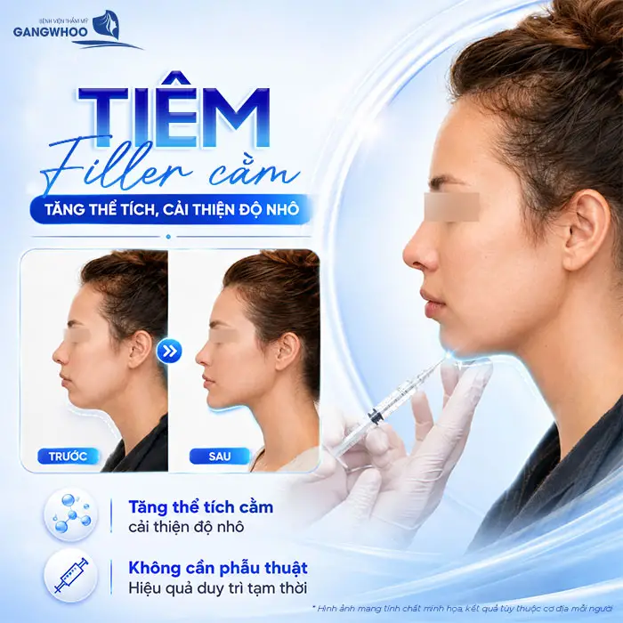 Độn Cằm Lẹm: Giải Pháp Cải Thiện Dáng Cằm Và Đường Nét Khuôn Mặt