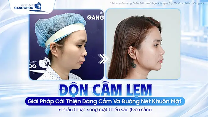 don cam lem