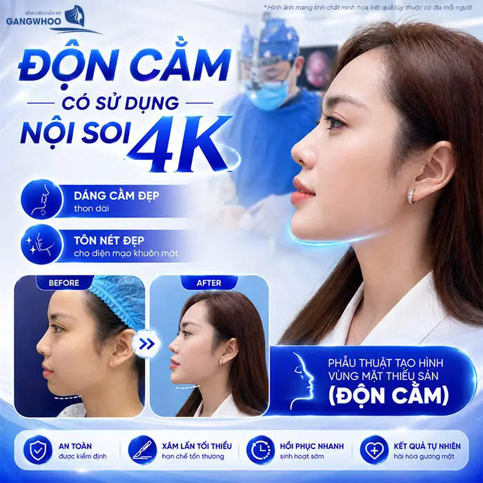 Độn Cằm Có Đau Không? Mức Độ Đau Và Thời Gian Hồi Phục