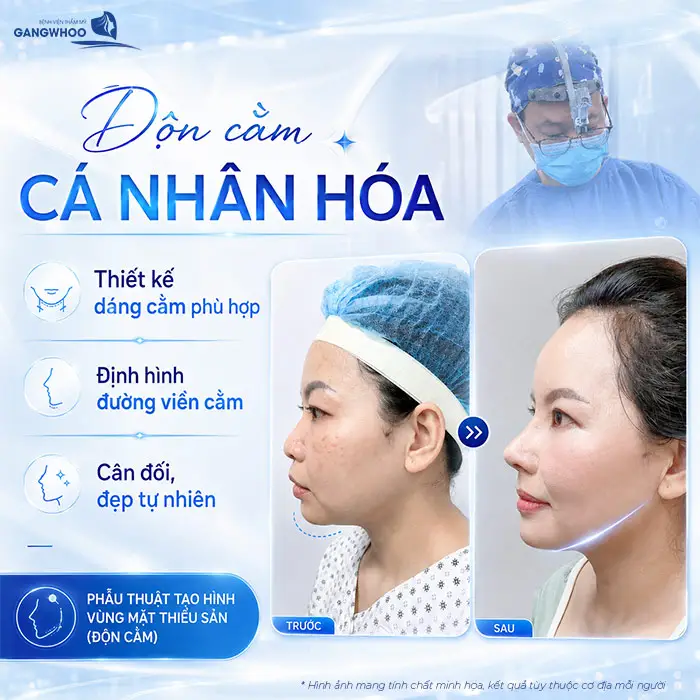 Độn Cằm Có Đau Không? Mức Độ Đau Và Thời Gian Hồi Phục