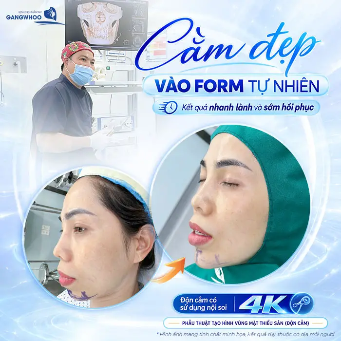Độn Cằm Có Đau Không? Mức Độ Đau Và Thời Gian Hồi Phục