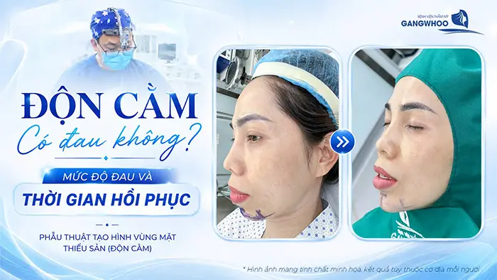 dong cam co dau khong
