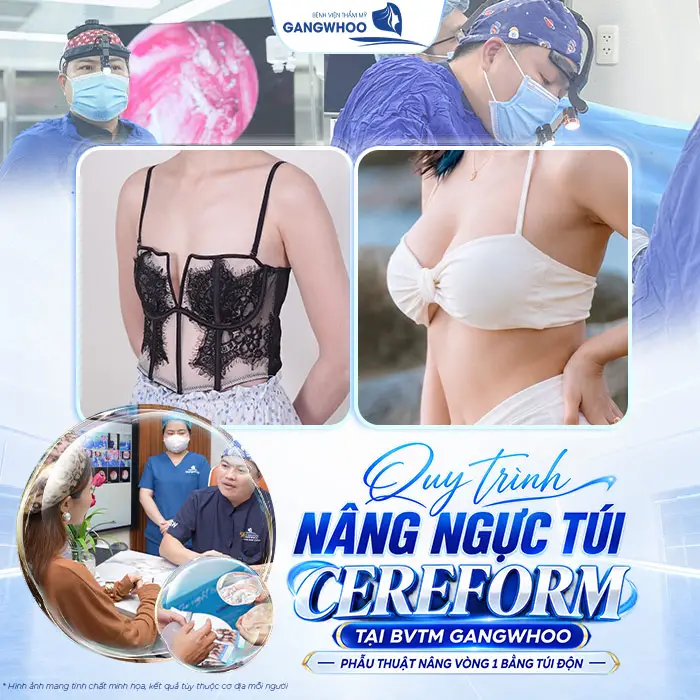Nâng Ngực Túi CereForm Từ Pháp: Đa Dạng Kích Thước, Cá Nhân Hóa Lựa Chọn 