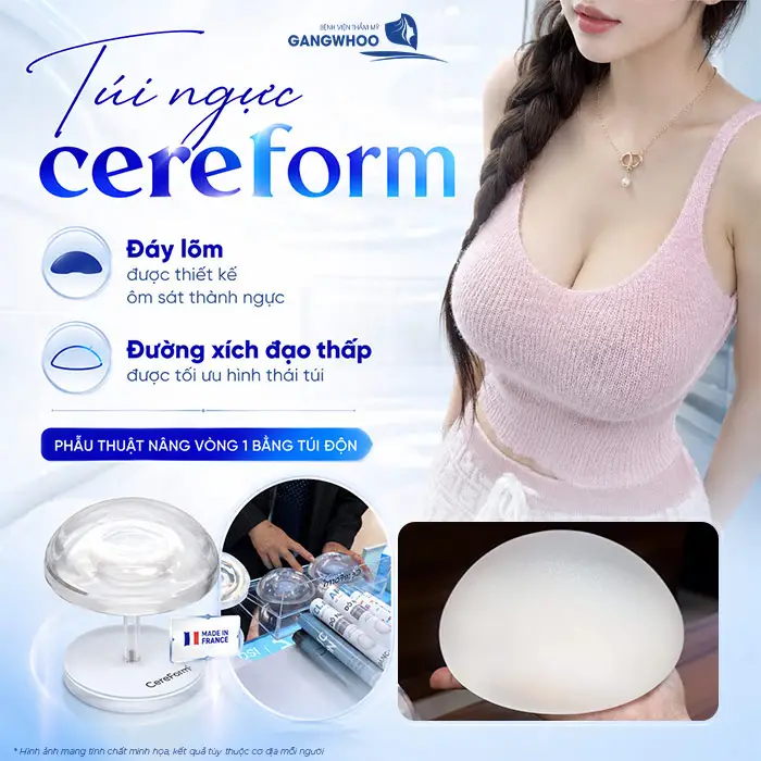 Nâng Ngực Túi CereForm Từ Pháp: Đa Dạng Kích Thước, Cá Nhân Hóa Lựa Chọn 