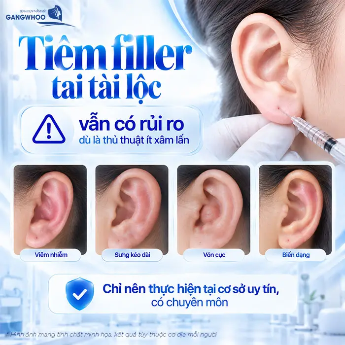 Tiêm Tai Tài Lộc Bao Nhiêu CC? Giữ Được Bao Lâu?