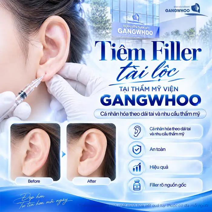 Tiêm Tai Tài Lộc Bao Nhiêu CC? Giữ Được Bao Lâu?