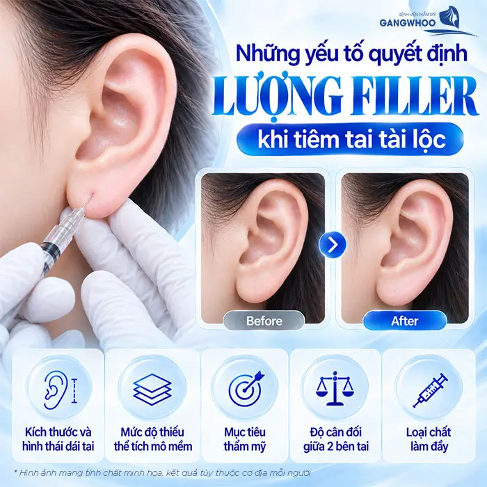 Tiêm Tai Tài Lộc Bao Nhiêu CC? Giữ Được Bao Lâu?