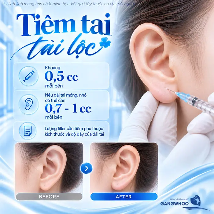 Tiêm Tai Tài Lộc Bao Nhiêu CC? Giữ Được Bao Lâu?