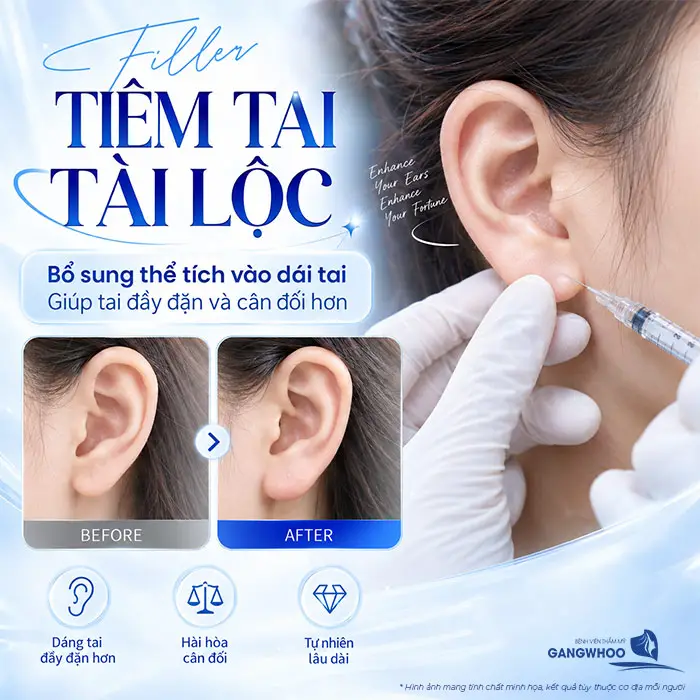 Tiêm Tai Tài Lộc Bao Nhiêu CC? Giữ Được Bao Lâu?
