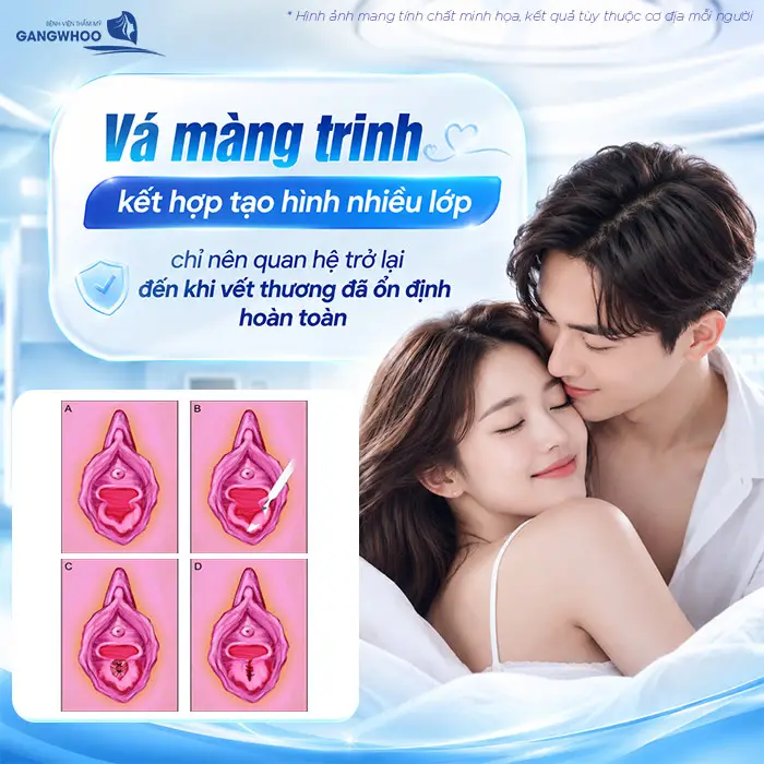 Vá Màng Trinh Bao Lâu Thì Quan Hệ Được? Bác Sĩ Giải Đáp Thời Điểm An Toàn