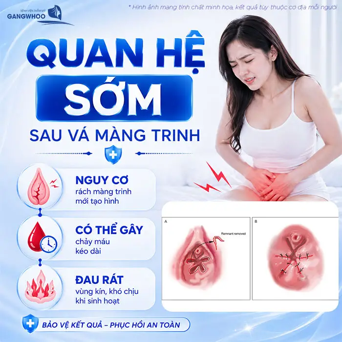 Vá Màng Trinh Bao Lâu Thì Quan Hệ Được? Bác Sĩ Giải Đáp Thời Điểm An Toàn