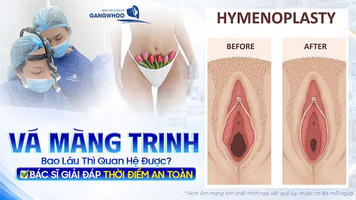 va mang trinh bao lau thi quan he duoc