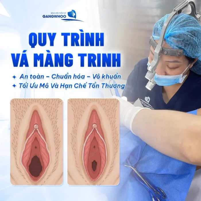 Vá Màng Trinh Có Nguy Hiểm Không? Giải Đáp Từ Góc Nhìn Chuyên Môn
