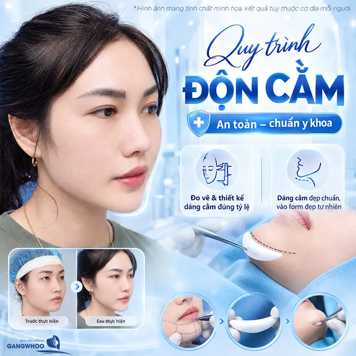Quy trình độn cằm an toàn và chuẩn y khoa dáng cằm đẹp chuẩn tỷ lệ gương mặt vào form chuẩn đẹp 