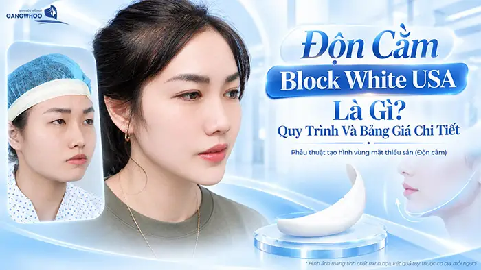 don cam block white usa