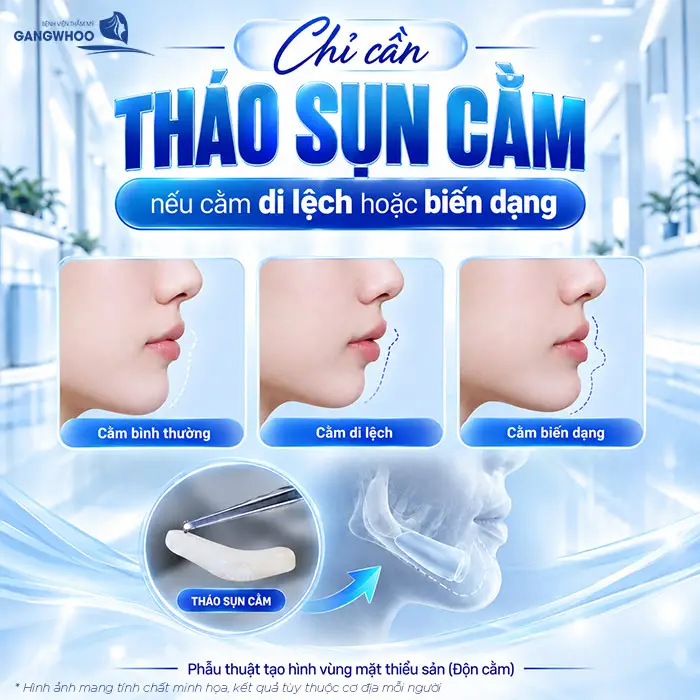 Độn Cằm Có Được Vĩnh Viễn Không? Những Yếu Tố Ảnh Hưởng