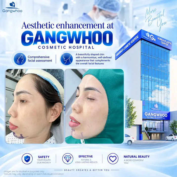 Can You Get Filler After Chin Augmentation? How Long Should You Wait Before Getting Filler? 5 At Gangwhoo, chin enhancement is shaped harmoniously and proportionately with the overall facial appearance