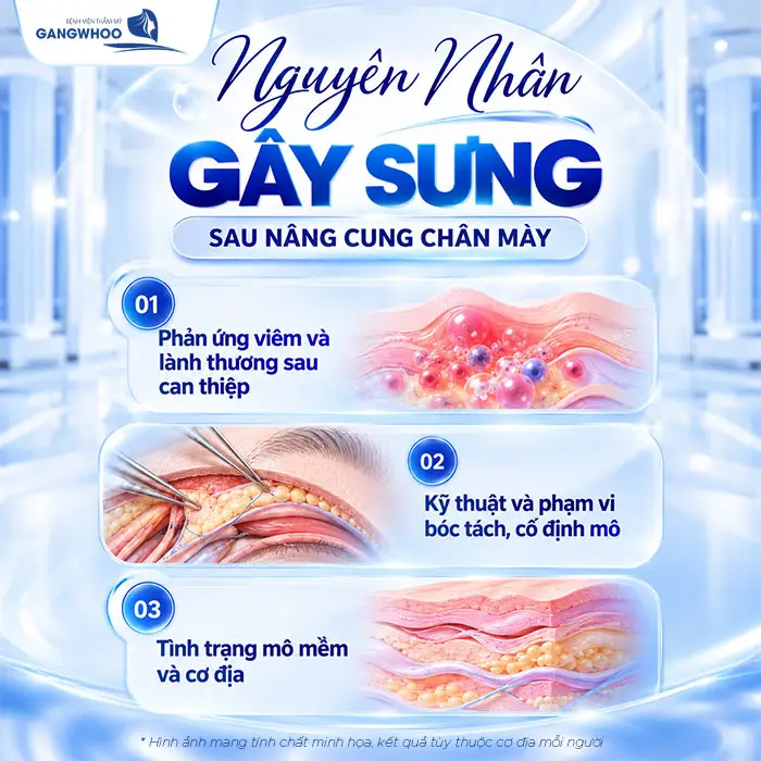 Nguyên nhân gây sưng sau nâng cung chân mày 