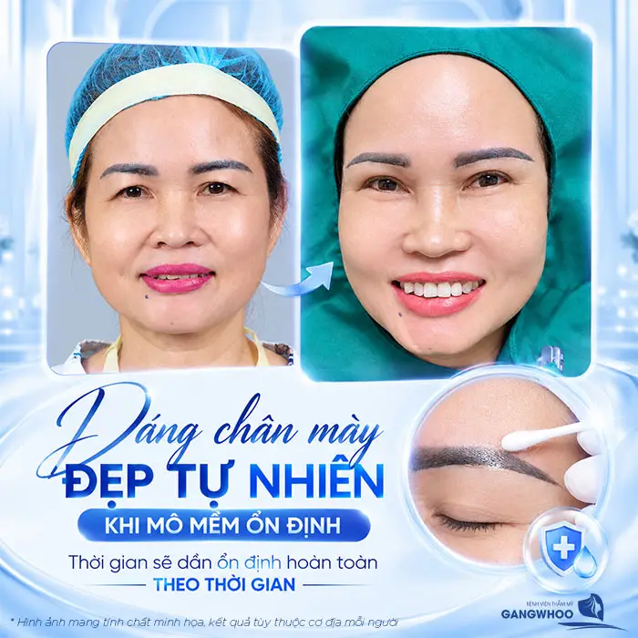 Dáng chân mày đẹp tự nhiên khi mô mềm ổn định thời gian sẽ dần ổn định hoàn toàn theo thời gian