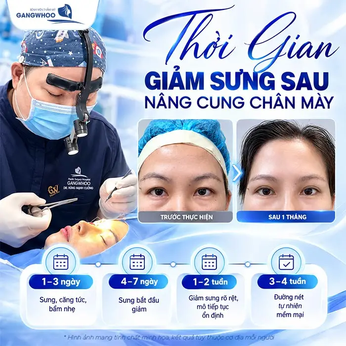 Thời gian giảm sưng đau sau nâng cung chân mày thường sẽ khoảng sau 3-4 tuần đường nét đã đẹp tự nhiên