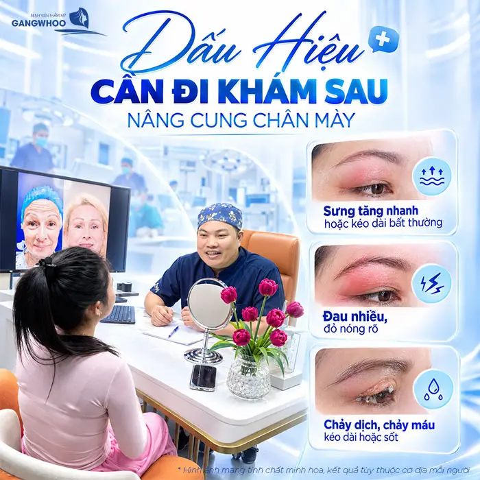 Dấu hiệu cần đi khám sau đi nâng cung chân mày