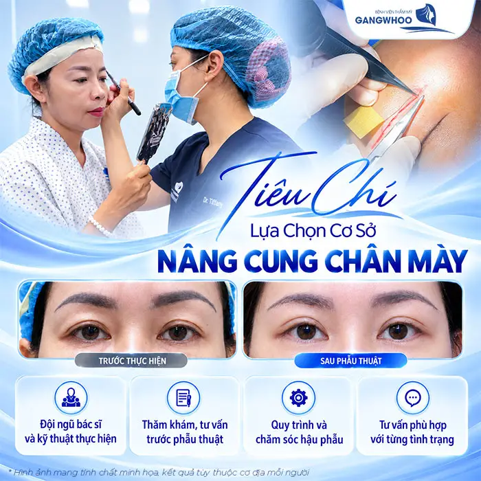 Nâng Cung Chân Mày Có Để Lại Sẹo Không? Hướng Dẫn Chăm Sóc Hạn Chế Sẹo