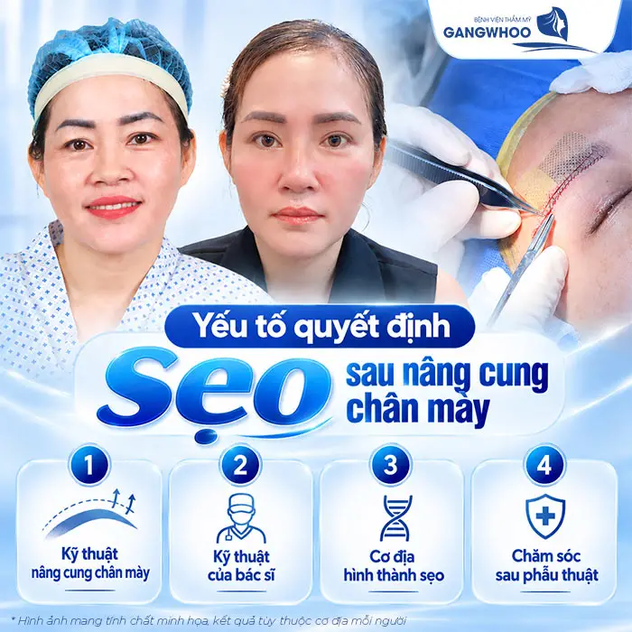 Nâng Cung Chân Mày Có Để Lại Sẹo Không? Hướng Dẫn Chăm Sóc Hạn Chế Sẹo