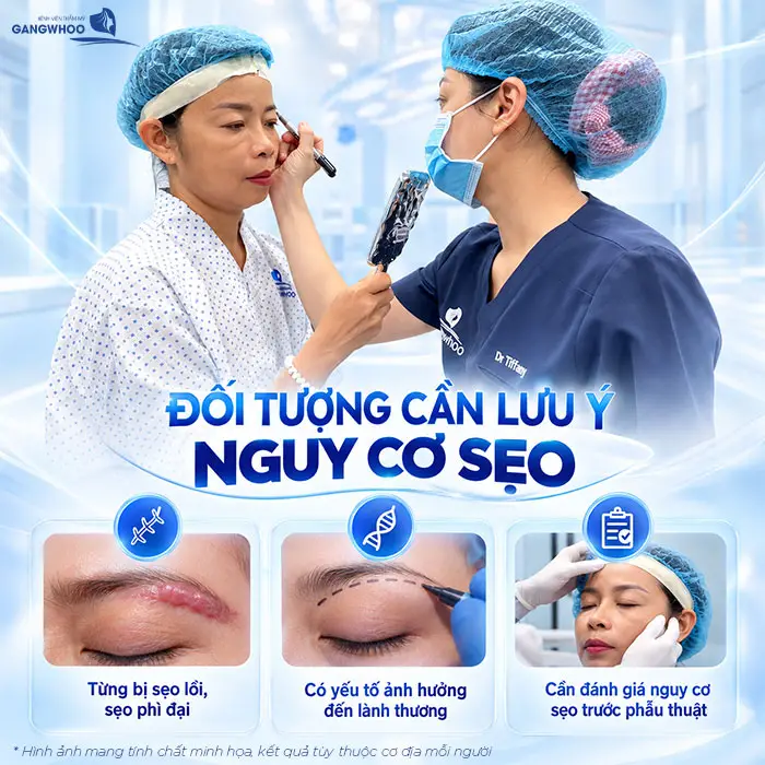 Nâng Cung Chân Mày Có Để Lại Sẹo Không? Hướng Dẫn Chăm Sóc Hạn Chế Sẹo